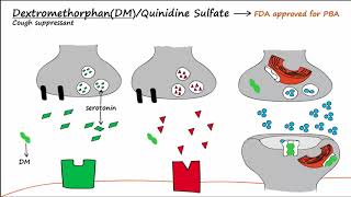 Pseudobulbar Affect PBA  Part 2  Treatment [upl. by Aceber]