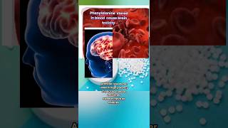 phenylalanine in aspartame may cause toxicity to braintake care in buying packed food [upl. by Umont]