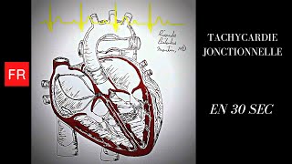 Arythmies animation cardiaque et ECG  Tachycardie Jonctionnelle Shorts [upl. by Hintze]