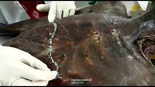 Surface marking of Liver By Dr Kalpana Sogala [upl. by Atika]