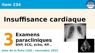 234  Insuffisance cardiaque  Partie 3  Examens paracliniques [upl. by Annauj]