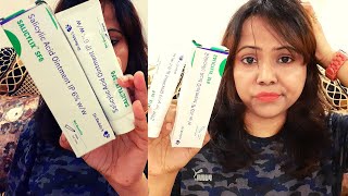 My 1 Month Experience  Salicylic Acid Ointment IP 6  SALICYLIX SF6 [upl. by Annahsal]