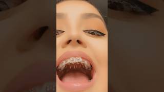 How Your Tongue Can RUIN Your Teeth 👅🦷 [upl. by Ajaj670]