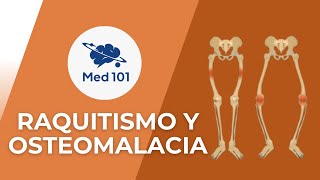 Raquitismo y osteomalacia 101 [upl. by Noraed267]