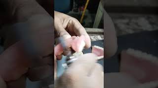 Final Finishing Of Flexible Partial Denture [upl. by Asirem]