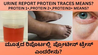 PROTEIN PRESENTTRACES IN URINE CAUSES SYMPTOMS AND TREATMENT OF PROTEIN IN URINE IN KANNADA [upl. by Lucilla888]