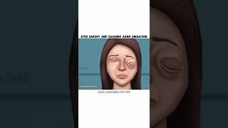 eyes sargry asmr animation vairal fyp asmr eyes skincare healthcare [upl. by Durware969]