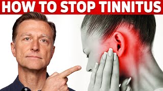 How to Stop Tinnitus ringing in the ears – Try DrBergs Home Remedy to Get Rid of It [upl. by Ennayt]