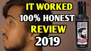 Beardo Beard Hair Growth Oil REVIEW 2019  IT WORKED [upl. by Ahsienet244]