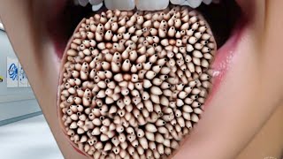 ASMR Treatment Animation Infected Insect On Tounge  ASMR No Talking Animation Treatment [upl. by Inanak]