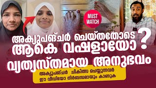 അക്യുപങ്ചർ ചെയ്തതോടെ ആകെ വഷളായോ  വ്യത്യസ്തമായ അനുഭവം  AcuPr Shuhaib Riyaloo [upl. by Pitts636]