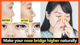 5 Best steps How to lift your nose bridge higher get perfect nose without surgery [upl. by Jeannie315]