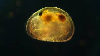 Ostracod egg [upl. by Jadd]