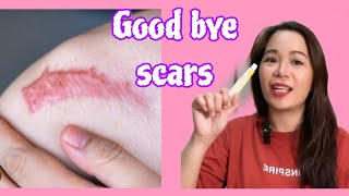 Scar remover Update Contractubex gel [upl. by Kimmy]