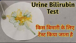 Bile pigment test in urine procedure [upl. by Gilberte863]