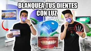 BLANQUEA TUS DIENTES CON LUZ EN 20 MINUTOS  FÁCIL Y RÁPIDO Resultados al Instante [upl. by Bagley]