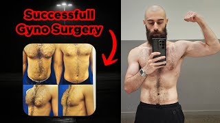 My Entire Gynecomastia Surgery Experience Plus Dos amp Donts [upl. by Tacye]