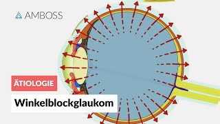 Akutes Winkelblockglaukom bei Pupillarblock  AMBOSS Video [upl. by Elleved976]