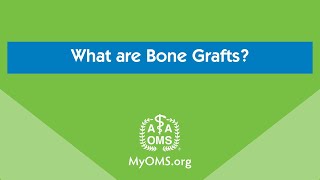 What are Bone Grafts [upl. by Wildon]