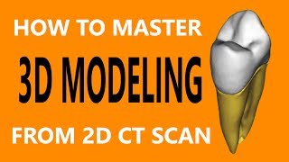 Mimics Tutorial │ Episode 1 Segmentation Of Premolar Tooth [upl. by Emsoc]