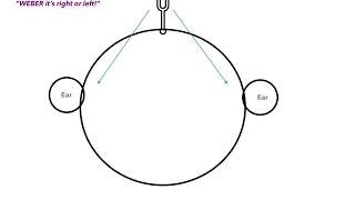 Weber vs Rinne Test amp Conductive vs Sensorineural Hearing Loss [upl. by Florentia]