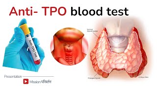 AntiTPO antibodies  treatment for high antiTPO [upl. by Orji]