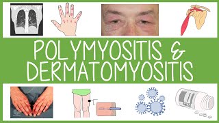 Polymyositis and Dermatomyositis in 3 Minutes [upl. by Anitsirt]