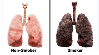 iQOS vs Traditional Regular Smoking  Lungs Harm Comparison [upl. by Alikee]