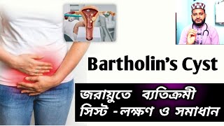 মেয়েদের তলপেটে তীব্র ব্যথা কেন হয়what is bartholin cyst birthlines abscess homeopathic treatment [upl. by Michelsen]