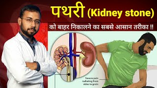 Pathri ko bahar nikalne ka Aasan tarika  pathri ka ilaj  kidney stone symptoms cause treatment [upl. by Rosenbaum]