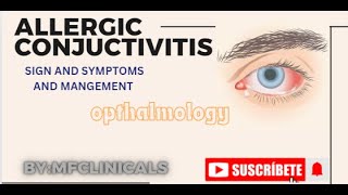 ALLERGIC CONJUCTIVITIS SIGN AND SYMPTOMS AND MANAGEMENT mbbs opthalmology [upl. by Lemrahs]