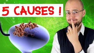 CANCER de la VESSIE  5 grandes causes [upl. by Ahsila189]