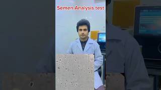 Semen Analysis  oligozoospermia amnioticfluid foryou viralshort microscope medicalstudent [upl. by Lled]