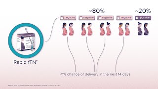 High Risk Pregnancy For Preterm Birth How The Fetal Fibronectin Test Gave Us Reassurance [upl. by Tomasina45]