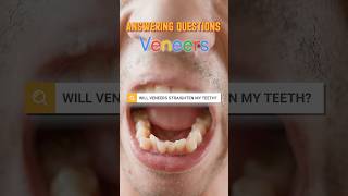 Will veneers straighten my crooked teeth Dentist explains [upl. by Eisinger651]