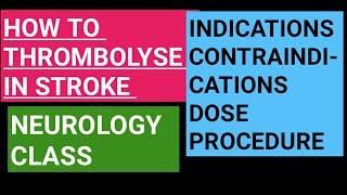 Thrombolysis in acute stroke  indications contraindications dose and procedure [upl. by Zeuqcaj]