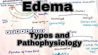 EdemaOedema  Types and its Pathophysiology [upl. by Nnawtna]