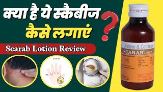 Scarab Lotion Kaise Lagaye  Lindane And Cetrimide Lotion  Scabies Aur Khujli Ke Liye Scarab Lotion [upl. by Burta]