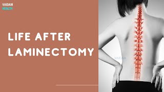 Life After Laminectomy [upl. by Dallman]