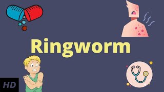 Ringworm Causes Signs and Symptoms Diagnosis and Treatment [upl. by Aihsatsan]