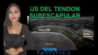 COMO EVALUAR EL TENDON SUBESCAPULAR EN ULTRASONIDOECOGRAFIA ULTRASOUND SUBESCAPULARIS [upl. by Einner]