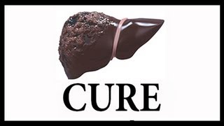 Part 1 of 5 LIVER CIRRHOSIS CURES  Natural Cure Treatment Remedy Liver Flush Protocol [upl. by Howie]