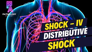 Understanding Distributive Shock  By Dr Aditi Kumar [upl. by Rona35]