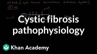 Cystic fibrosis pathophysiology  Respiratory system diseases  NCLEXRN  Khan Academy [upl. by Adai]