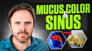 What The Color of Your Mucus Says About Your Health  Insights by Dr J [upl. by Ulrich]