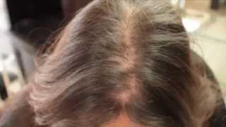 Hair loss in women treatment Testimonial hair cubed [upl. by Leoni203]