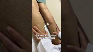 Gastrocnemius muscle tear physiotherapy dryneedling rehab musclestrengthening drvidhikaushik [upl. by Noired]