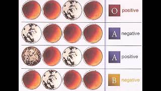 Understanding Blood Type Results  Review and Practice [upl. by Eade]