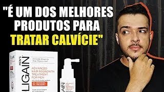 TRIOXIDIL SERVE PARA TRATAR QUEDA DE CABELO e CALVÍCIE MASCULINA [upl. by Adnyc]