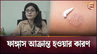 ফাঙ্গাস আক্রান্ত হওয়ার কারণ  Fungal Infection  Health Tips  Channel 24 [upl. by Iret]